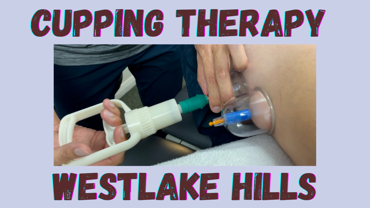 Cupping Therapy in Westlake Hills, Austin Tx