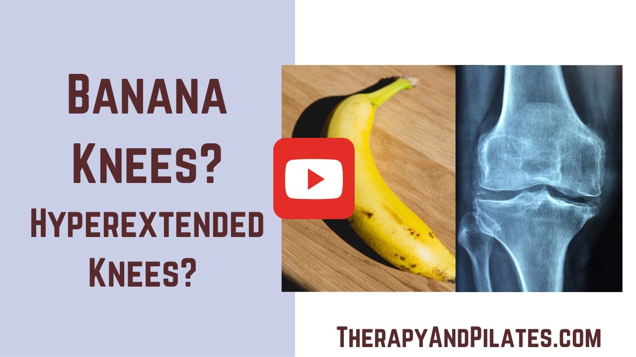 Do you have Hyperextended Knees Banana Knees Try these Knee Hyperextension Exercises