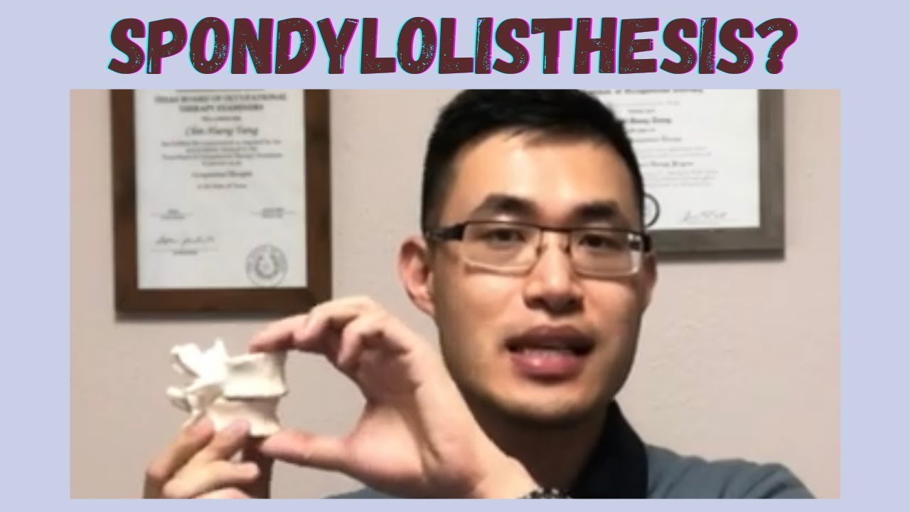 What is Lumbar Spondylolisthesis